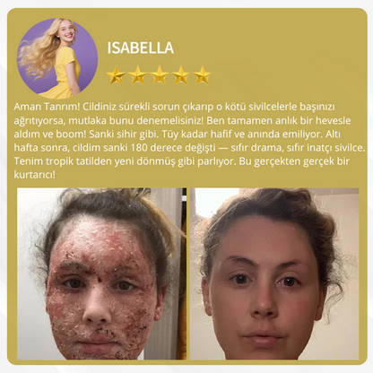 AlphaClean™ Bee Venom All-in-One Cream US Dermatologist Approved🍃