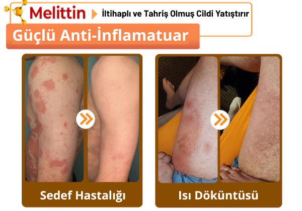 AlphaClean™ Bee Venom All-in-One Cream US Dermatologist Approved🍃