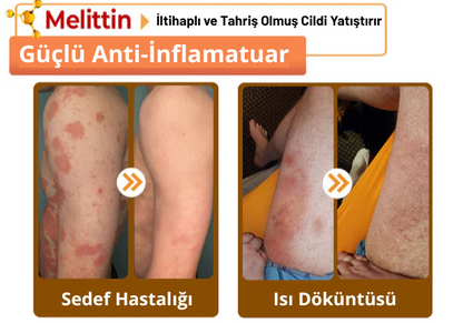 AlphaClean™ Bee Venom All-in-One Cream US Dermatologist Approved🍃