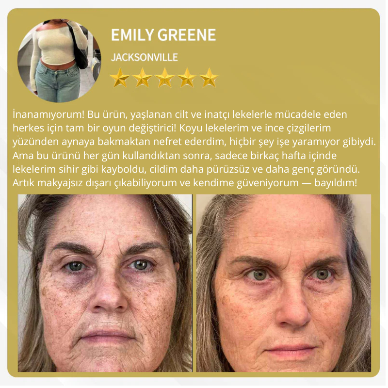 AlphaClean™ Bee Venom All-in-One Cream US Dermatologist Approved🍃