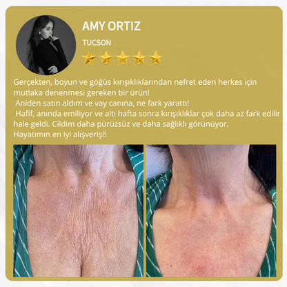 AlphaClean™ Bee Venom All-in-One Cream US Dermatologist Approved🍃