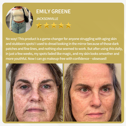 AlphaClean™ Bee Venom All-in-One Cream US Dermatologist Approved🍃